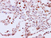 Immunohistochemistry of paraffin-embedded Human lung using ERK8 Polyclonal Antibody at dilution of 1:200