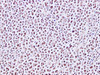 Immunohistochemistry of paraffin-embedded Human lymph node using CDC46 Polyclonal Antibody at dilution of 1:200
