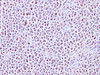 Immunohistochemistry of paraffin-embedded Human lymph node using MEF-2C Polyclonal Antibody at dilution of 1:200