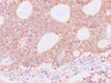 Immunohistochemistry of paraffin-embedded Humancolon using RAF1 Polyclonal Antibody at dilution of 1:200