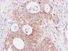 Immunohistochemistry of paraffin-embedded Humancolon using SNAP23 Polyclonal Antibody at dilution of 1:200