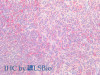 Immunohistochemistry of paraffin-embedded Human spleen using SNAP23 Polyclonal Antibody at dilution of 1:200(Elabscience® Product Detected by Lifespan).