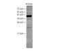 Western Blot analysis of Mouse brain tissue using ATXN3 Polyclonal Antibody at dilution of 1:500