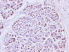 Immunohistochemistry of paraffin-embedded Human pancreas tissue using IL1A Polyclonal Antibody at dilution of 1:200