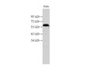 Western Blot analysis of HeLa cell using PKM Polyclonal Antibody at dilution of 1:500