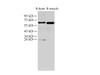 Western Blot analysis of Rat heart and Rat muscle using AMPK alpha2 Polyclonal Antibody at dilution of 1:1000