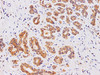 Immunohistochemistry of paraffin-embedded Human breast using AMPK alpha2 Polyclonal Antibody at dilution of 1:100