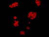 Immunofluorescence analysis of McF7 cells using AMPK alpha2 Polyclonal Antibody at dilution of 1:100