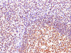 Immunohistochemistry of paraffin-embedded Human tonsil using CBX5 Polyclonal Antibody at dilution of 1:100