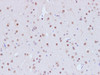 Immunohistochemistry of paraffin-embedded Rat brain using CBX5 Polyclonal Antibody at dilution of 1:100