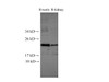 Western Blot analysis of Rat testis and Rat kidney using Runx2 Polyclonal Antibody at dilution of 1:500