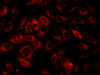 Immunofluorescence analysis of Hela cells using IFITM3 Polyclonal Antibody at dilution of 1:100
