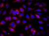 Immunofluorescence analysis of Hela cells using ifitm3 Polyclonal Antibody at dilution of 1:100