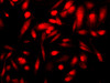 Immunofluorescence analysis of PC-3 cells  using p16 Polyclonal Antibody at dilution of 1:100