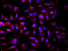 Immunofluorescence analysis of HepG2 cells using GCK Polyclonal Antibody at dilution of 1:100