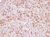 Immunohistochemistry of paraffin-embedded Human liver using CCL2 Polyclonal Antibody at dilution of 1:100