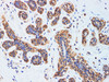 Immunohistochemistry of paraffin-embedded Human breast using CCL2 Polyclonal Antibody at dilution of 1:200