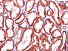 https://file.elabscience.com//image/antibody/EA/E-AB-40281-IHC04.jpg