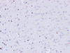 Immunohistochemistry of paraffin-embedded Mouse brain  using BRCA1 Polyclonal Antibody at dilution of 1:100