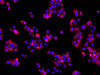 Immunofluorescence analysis of A431 cells  using EGFR Polyclonal Antibody at dilution of 1:100