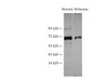 Western Blot analysis of Mouse testis and Mouse thymus using PTEN Polyclonal Antibody at dilution of 1:500