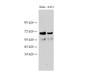 Western Blot analysis of HeLa and A431 cells using PTEN Polyclonal Antibody at dilution of 1:500