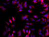 Immunofluorescence analysis of HepG2 cells  using GSTM1 Polyclonal Antibody at dilution of 1:100