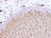 Immunohistochemistry of paraffin-embedded Human cervix using S100A8 Polyclonal Antibody at dilution of 1:100(400×)