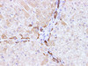 Immunohistochemistry of paraffin-embedded Human liver  using CK-7 Polyclonal Antibody at dilution of 1:100