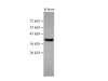 Western Blot analysis of Rat Heart using EpCAM Polyclonal Antibody at dilution of 1:500