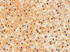 Immunohistochemistry of paraffin-embedded Human liver using HSPA1A Polyclonal Antibody at dilution of 1:200