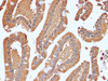 Immunohistochemistry of paraffin-embedded Human duodenum using NRAS Polyclonal Antibody at dilution of 1:100(400×)