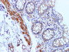 Immunohistochemistry of paraffin-embedded Human colon using COL1A1 Polyclonal Antibody at dilution of 1:100(400×)