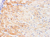 Immunohistochemistry of paraffin-embedded Human liver using IFNAR1 Polyclonl Antibody at dilution of 1:200.