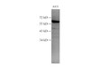 Western Blot analysis of A431 using c-SRC Polyclonl Antibody at dilution of 1:1000.