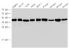 Western Blot analysis of HepG2, HT-29, A549, Jurkat, MCF-7, Rat heart, Mouse brain, Mouse heart and Rat brain using GAPDH Polyclonal Antibody at dilution of 1:5000