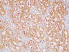 https://file.elabscience.com//image/antibody/EA/E-AB-40337-IHC02.jpg