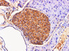 https://file.elabscience.com//image/antibody/EA/E-AB-40339-IHC03.jpg