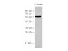 Western Blot analysis of Rat thymus cells  using PDCD4 Polyclonal Antibody at dilution of 1:500