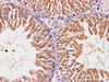 https://file.elabscience.com//image/antibody/EA/E-AB-40342-IHC04.jpg