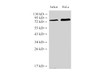 Western Blot analysis of Jurkat and Hela Cells  using IL6R Polyclonal Antibody at dilution of 1:2000
