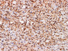 Immunohistochemistry of paraffin-embedded Human ovary using S100A11 Polyclonal Antibody at dilution of 1:200
