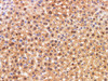 https://file.elabscience.com//image/antibody/EA/E-AB-40345-IHC04.jpg