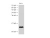 Western Blot analysis of Hela cells using B2M Polycloanl Antibody at dilution of 1:2000