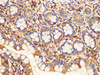 Immunohistochemistry of paraffin-embedded Human colon using B2M Polycloanl Antibody at dilution of 1:100(400×)