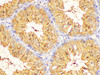 https://file.elabscience.com//image/antibody/EA/E-AB-40359-IHC02.jpg