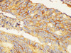 Immunohistochemistry of paraffin-embedded Human colon using CD44 Polycloanl Antibody at dilution of 1:200