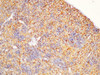 https://file.elabscience.com//image/antibody/EA/E-AB-40361-IHC04.jpg