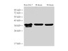 Western Blot analysis of 1)Raw264.7, 2)Rat brain, 3)Mouse brain using LDHA Polycloanl Antibody at dilution of 1:2000
