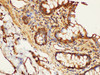 Immunohistochemistry of paraffin-embedded Human colon using LDHA Polycloanl Antibody at dilution of 1:300